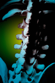 Chiropractic and Placebos, sciatic nerve treatment billings mt